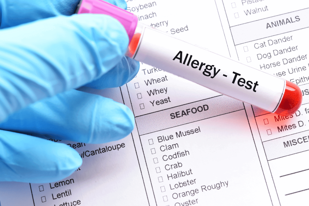 allergy results after identifying allergy from bedbugs in cape flats